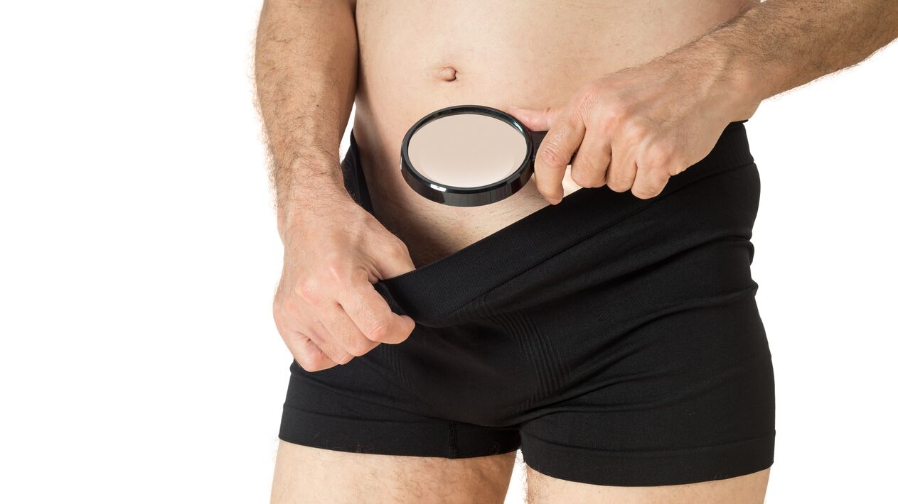 Complexe masculine